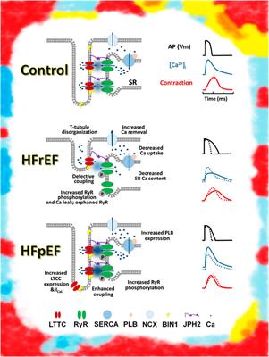 Editorial: Heart failure with preserved ejection fraction: Basic, translational, and clinical research